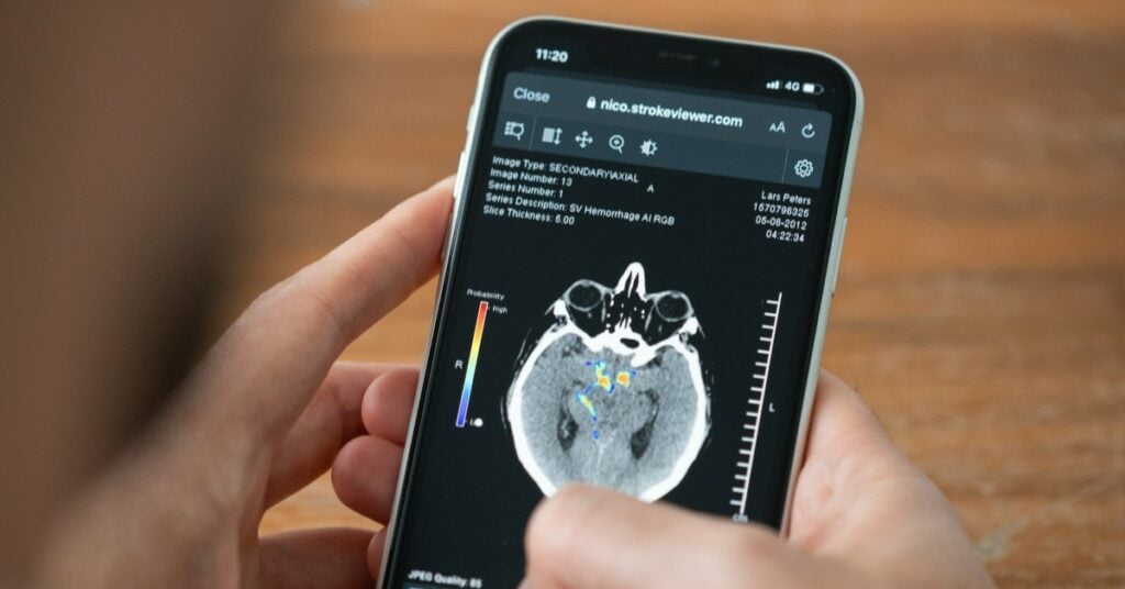 Nicolab strokeviewer mobile