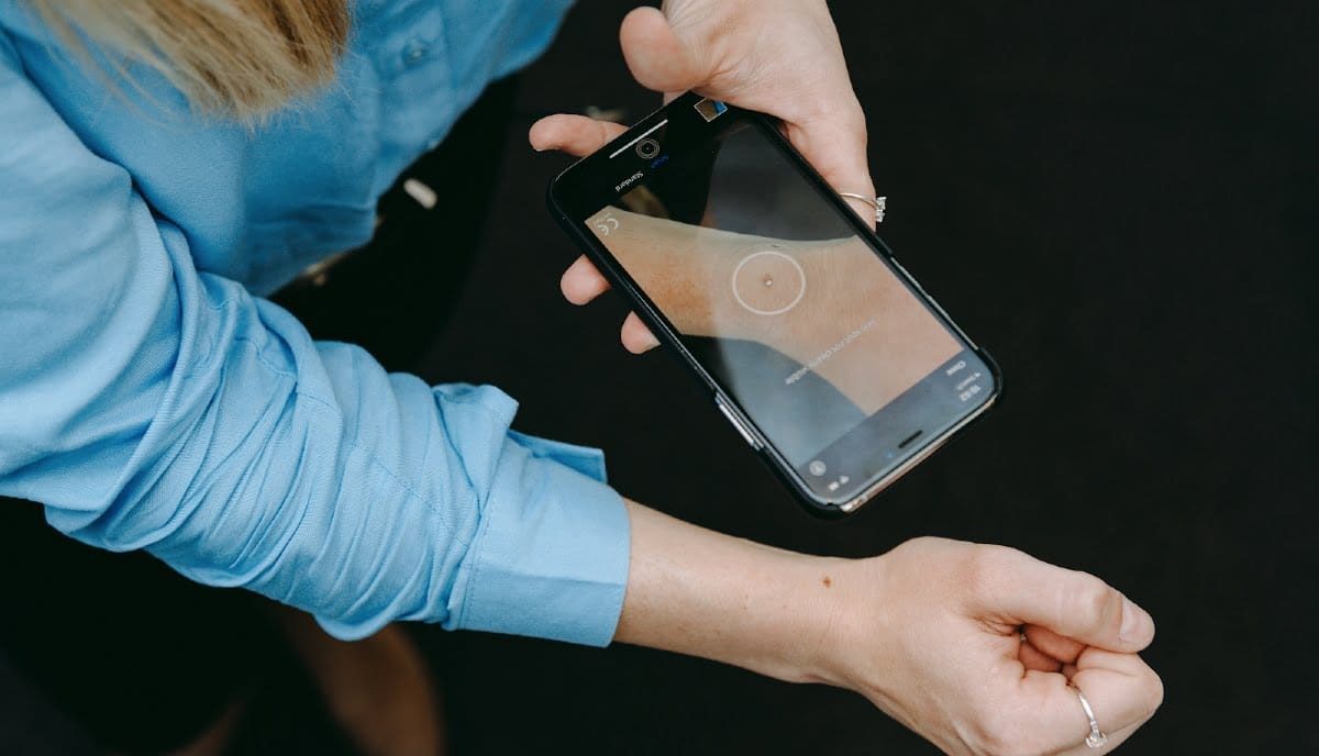 SkinVision: AI-powered app spots 95% of skin cancer, Amsterdam startup talks about pandemic, partnership and more
