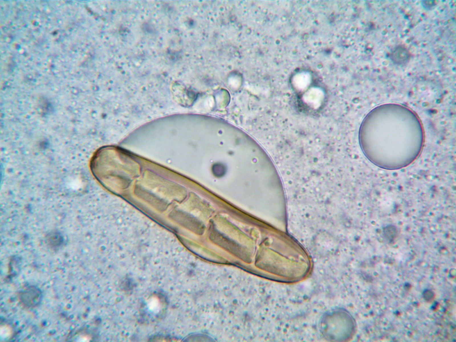 Tardigrades can survive freezing near absolute zero, extreme radiation, and the vacuum of space by drying into glass-like tuns that suspend their biology until conditions improve